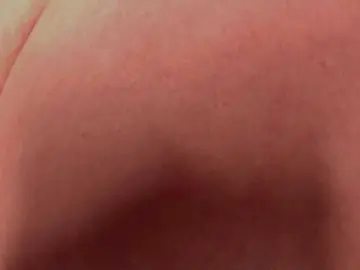 Causeoferection  live sex cam