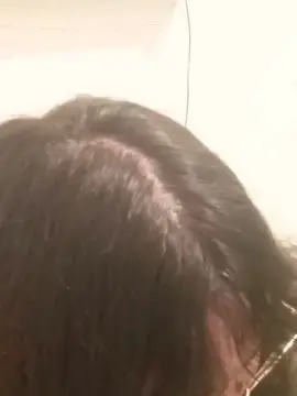 Poisondaysi1  live sex cam