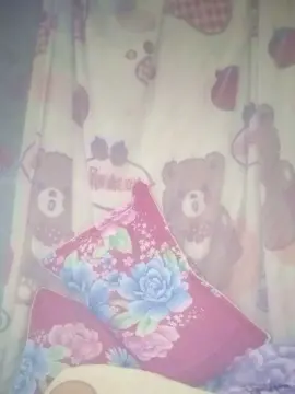 Melasma27  live sex cam