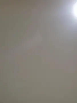 Tumorvosa  live sex cam