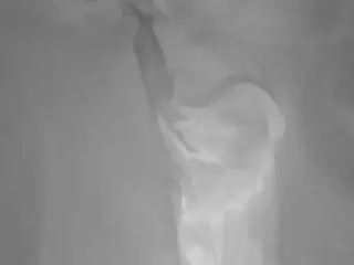 Voyeurcam-baileybase-shower  live sex cam