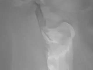 Voyeurcam-baileybase-shower  live sex cam
